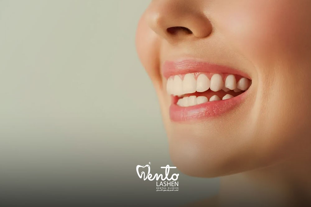 Teeth whitening image